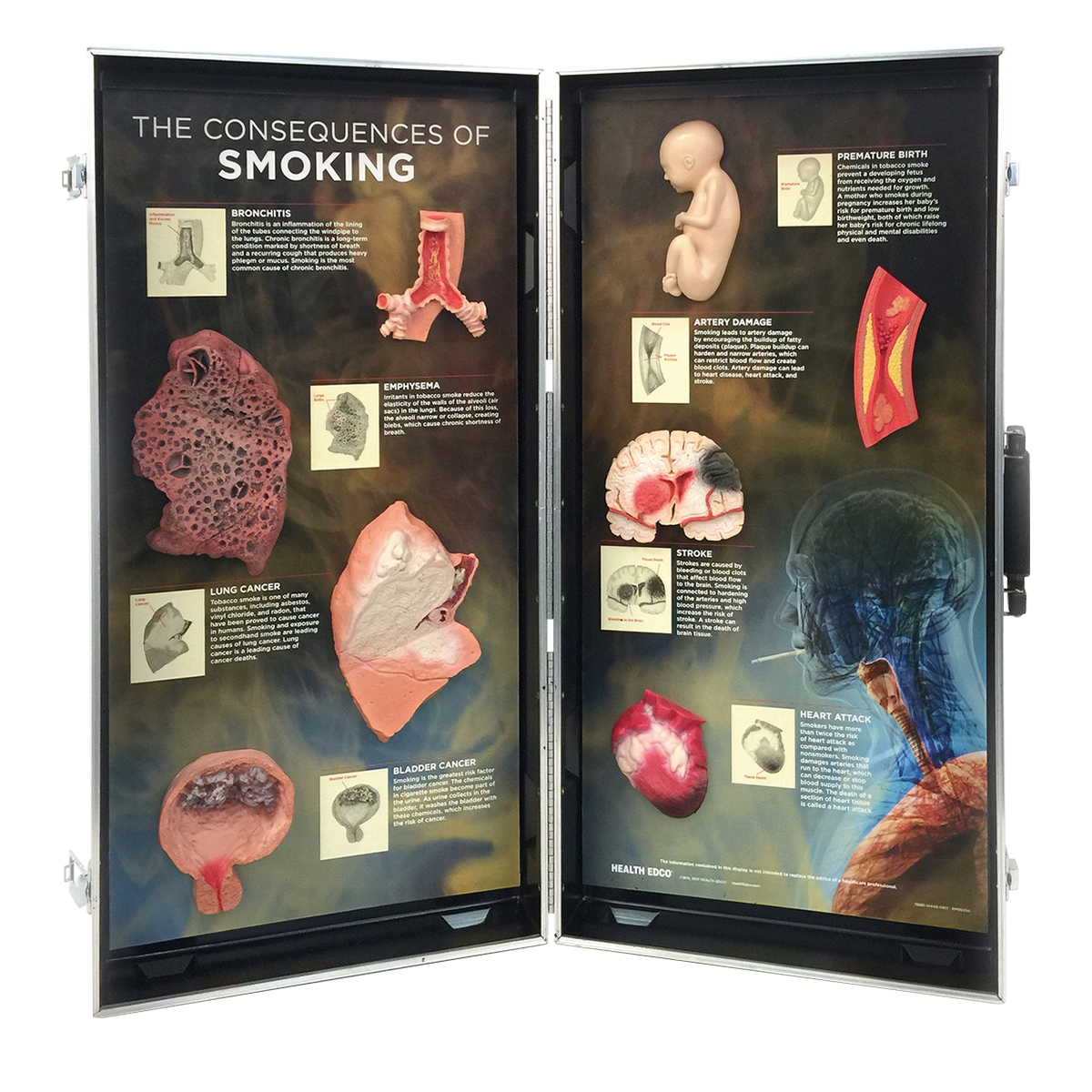 De gevolgen van roken 3D Display