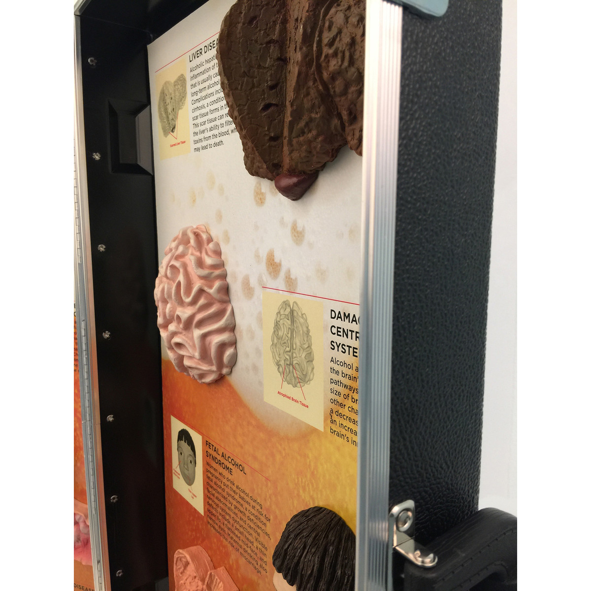 De gevolgen van alcohol 3D Display