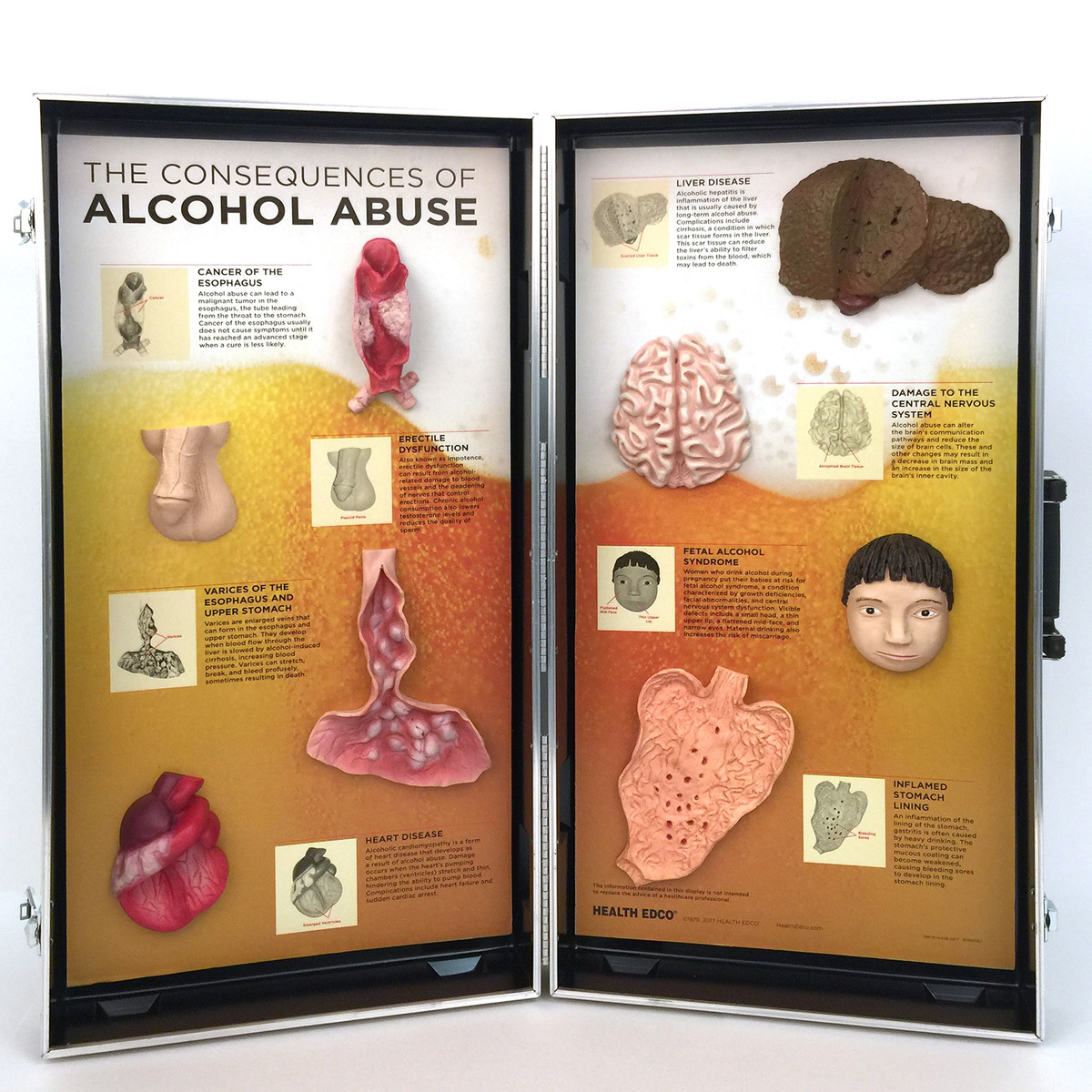 De gevolgen van alcohol 3D Display