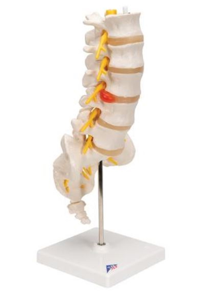 Lumbale wervelkolom: trauma