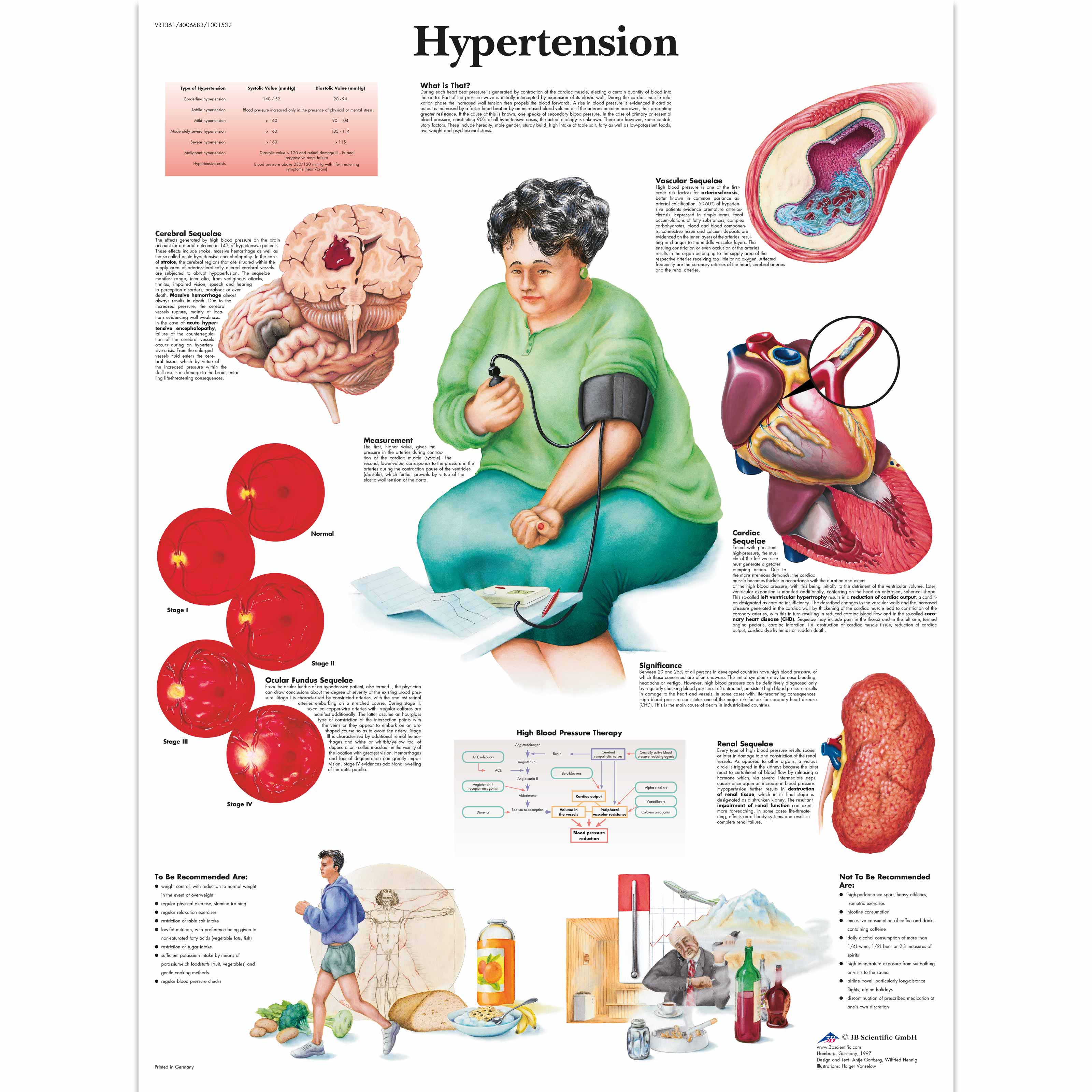 Anatomie poster hypertensie