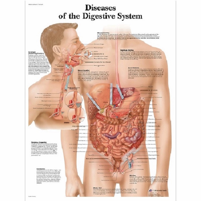 Anatomie posters pathologie