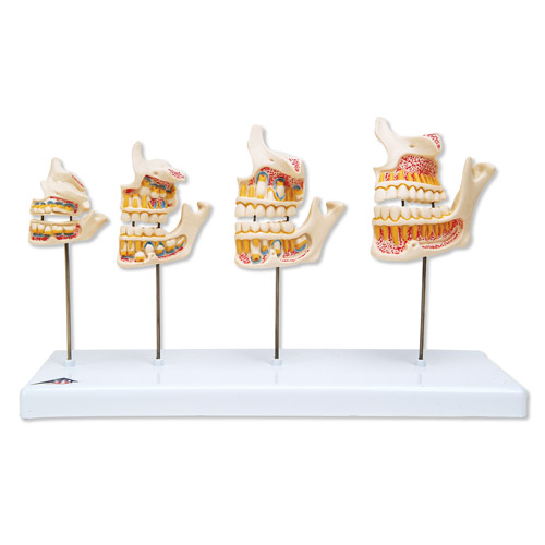 Gebit ontwikkeling model