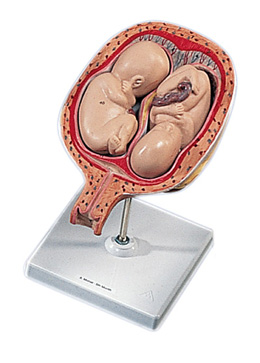 Foetus 5e maand tweeling