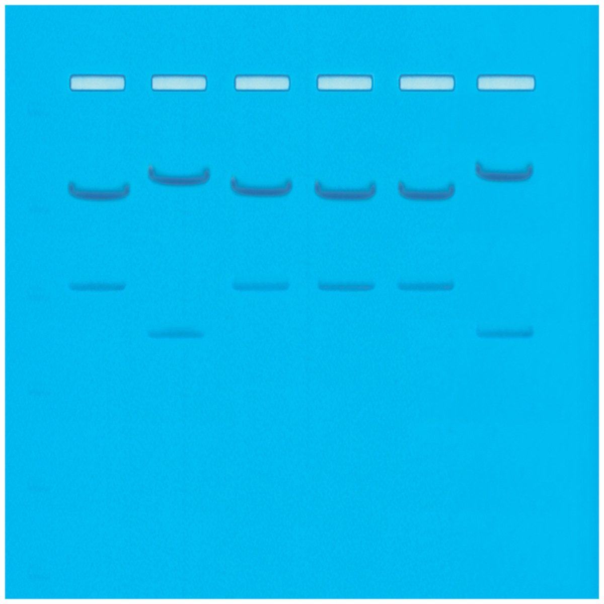DNA Fingerprinting by Restriction Enzyme