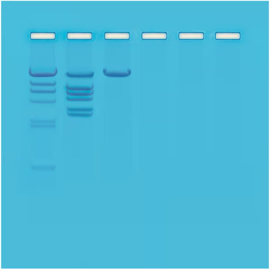 Restriction Enzyme Analysis of DNA