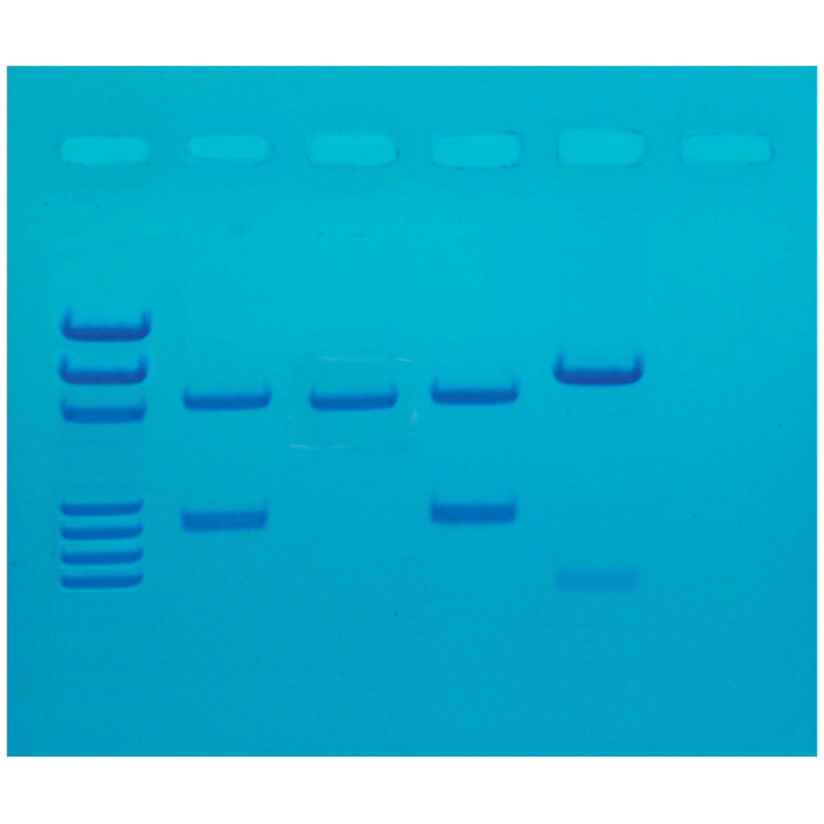 DNA Fingerprinting door PCR Amplificatie
