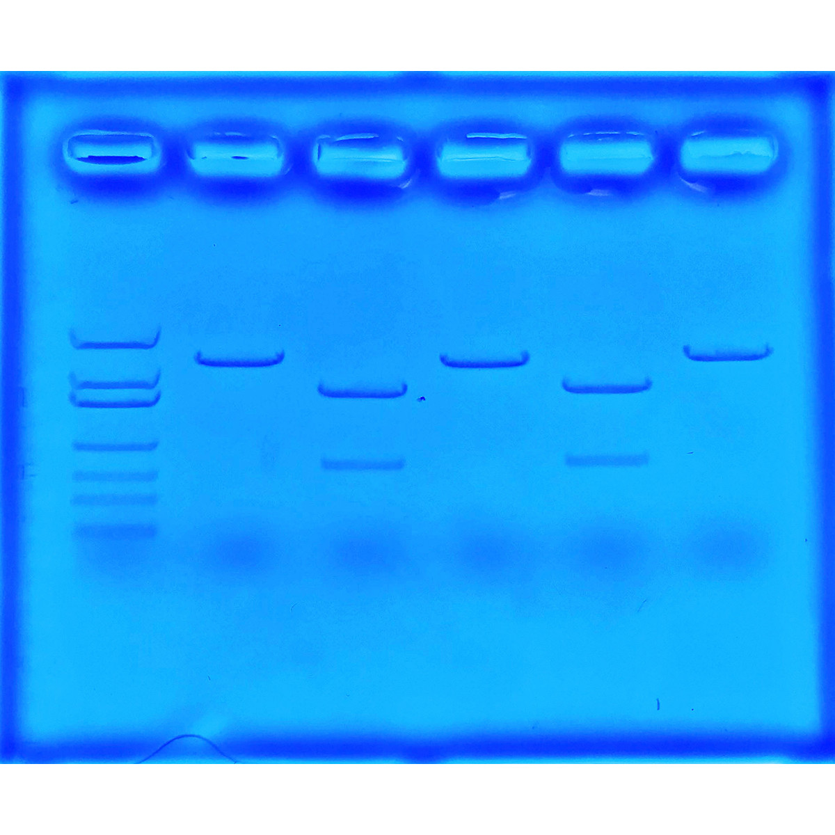 CRISPR voor behandeling Cystic Fibrosis