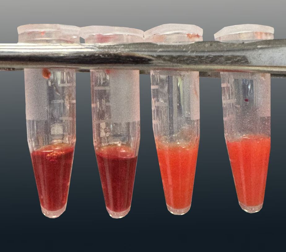 Bloedtypering voor Stamcel transplantati