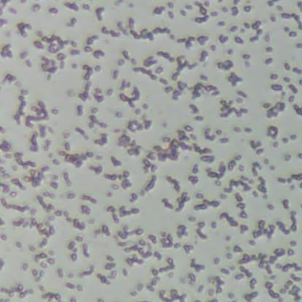 Identification and Characterization of B