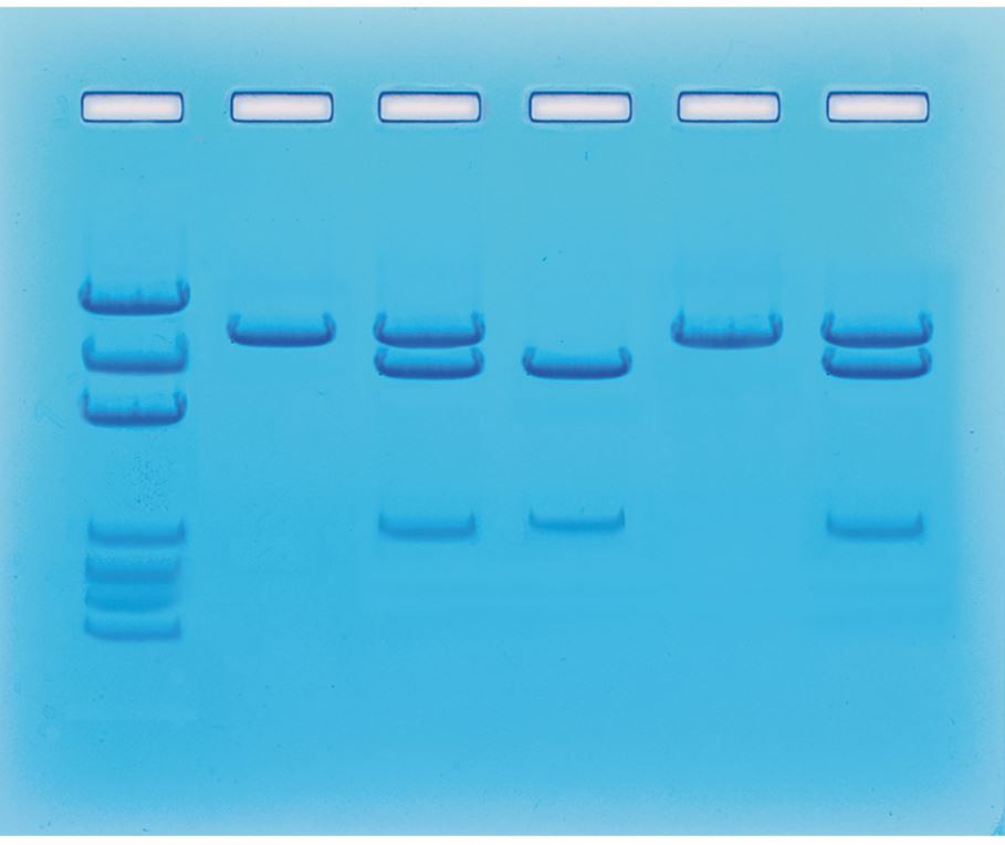 Nucleic Acid Testing for COVID-19