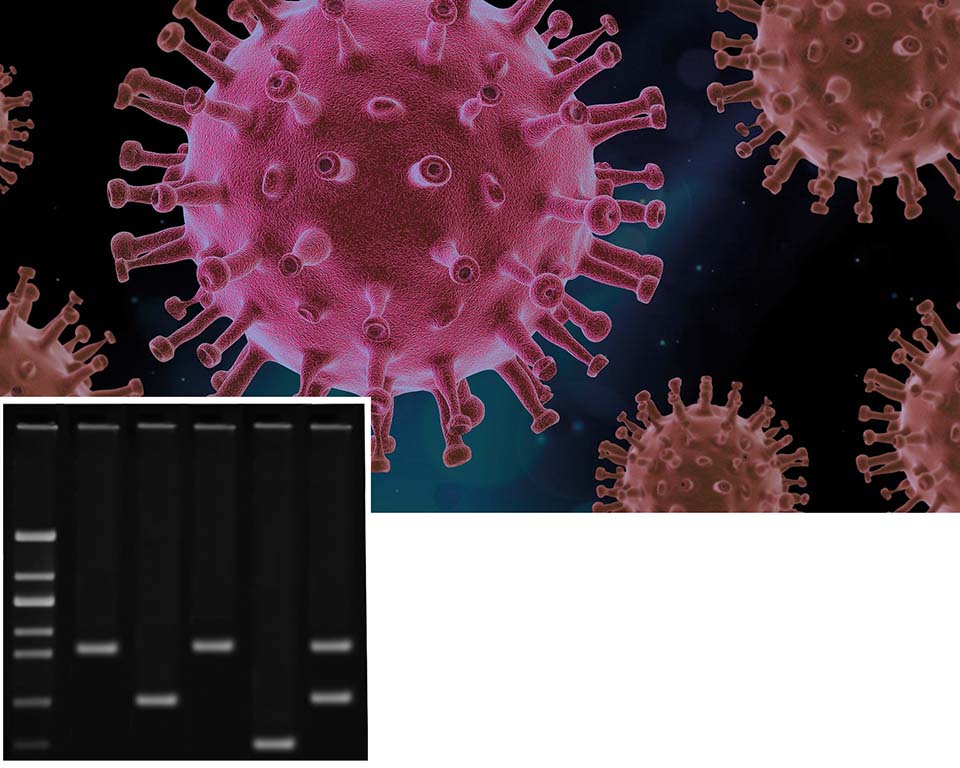 Detecting COVID-19 Using Reverse-Transcr