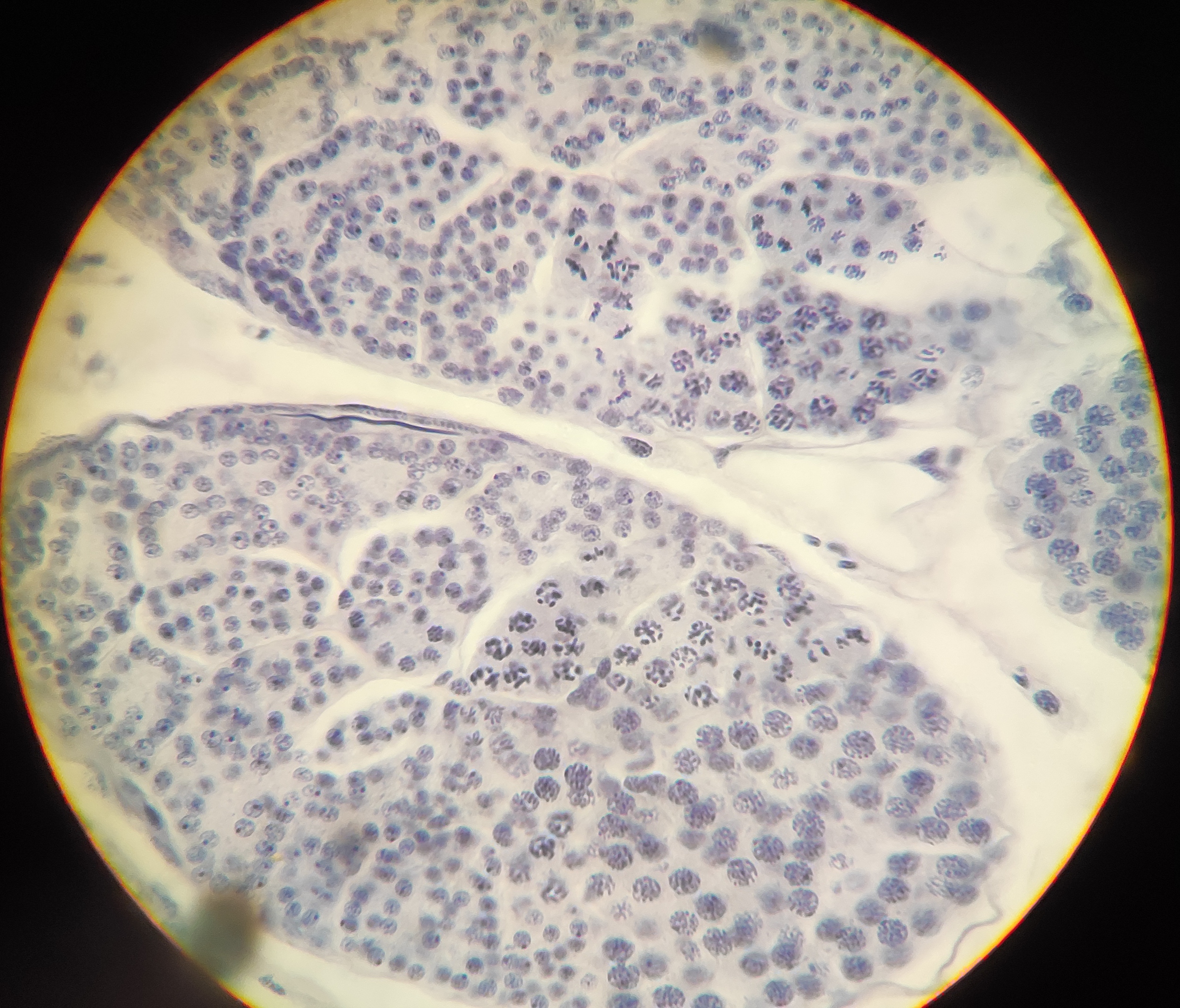 Spermatogenesis meiotic & mitotic stages