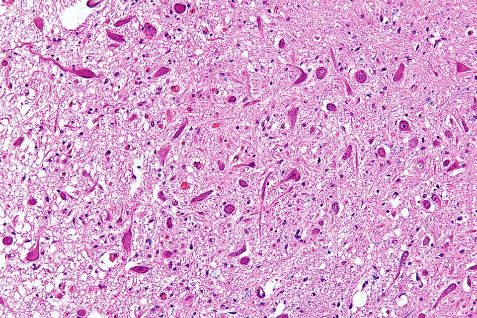 Medulla oblongata, human, t.s. routine s