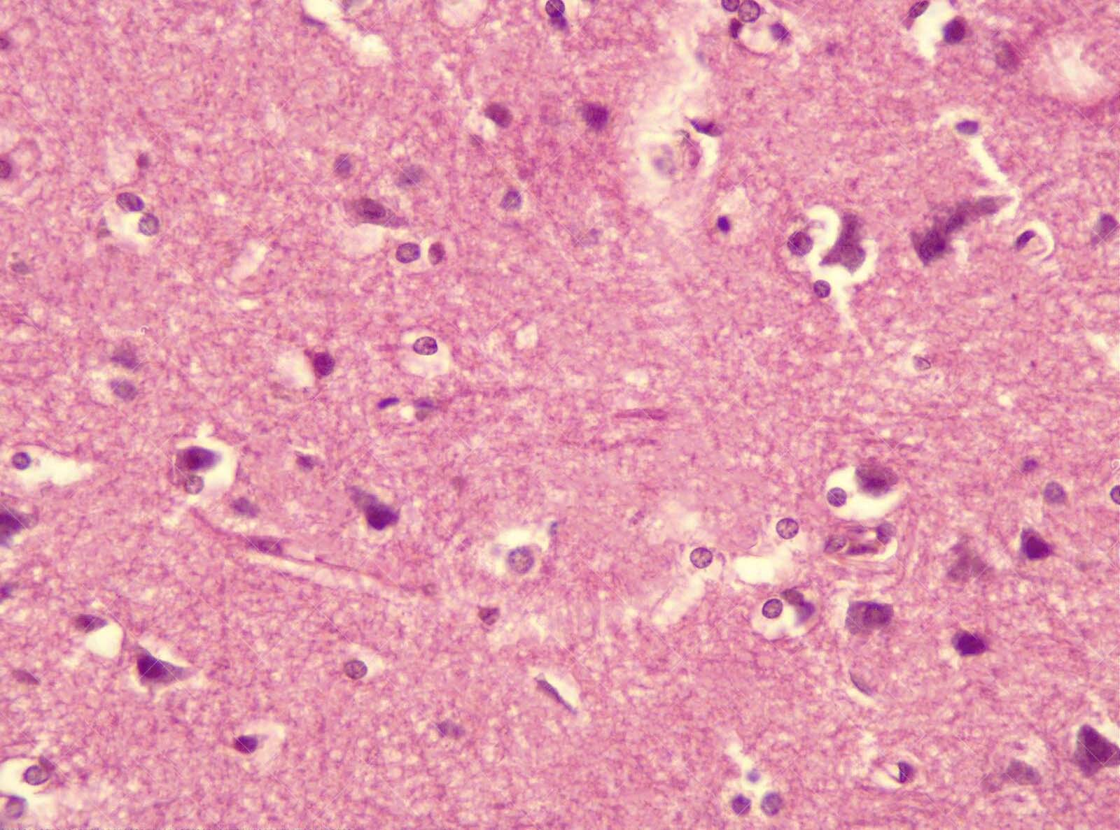 Cerebrum