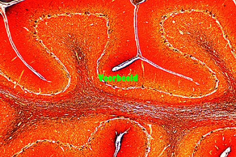 Cerebellum, dwarsdoorsnede