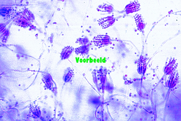 Penicillium, blauwschimmel