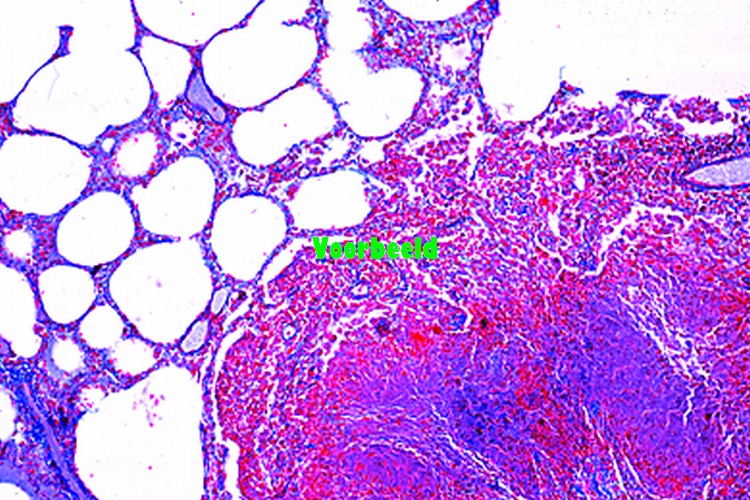 Menselijke pathologie set 1, individueel