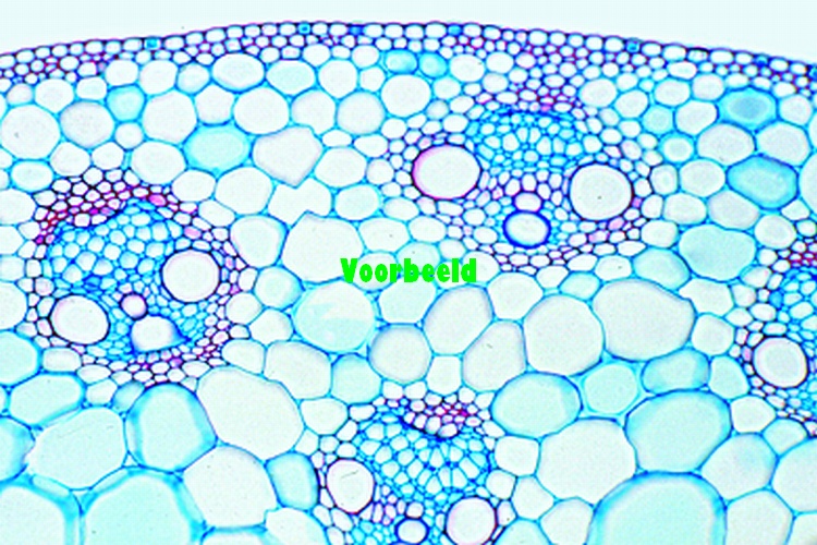 Monocot and dicot stems, two t.s. for co