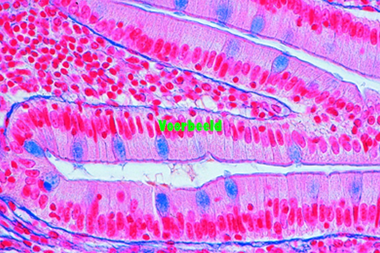 Columnar epithelium, t.s of blind gut fr