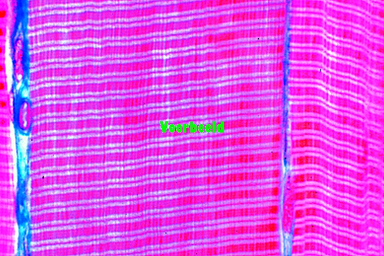 Striated muscles of mammal, l.s.