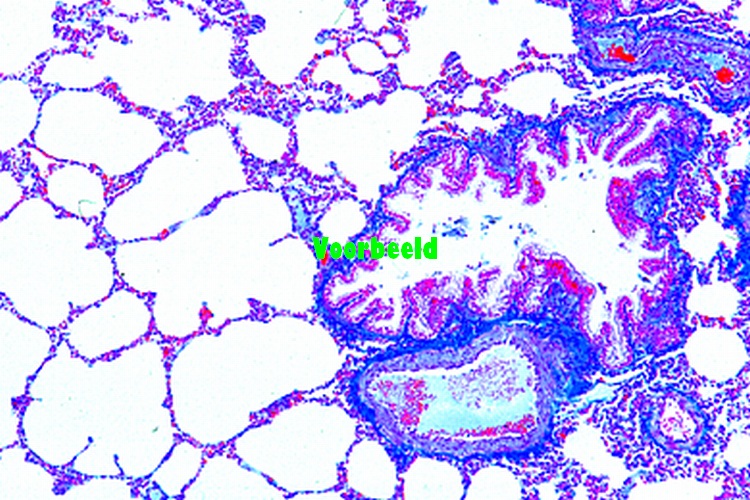 Lung of cat, t.s.