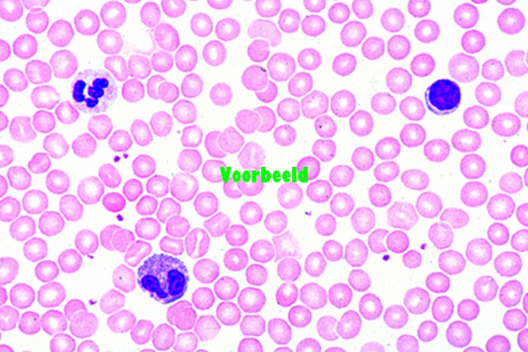 Human blood smear