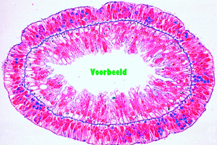 Hydra, fresh water polyp, t.s. with ecto