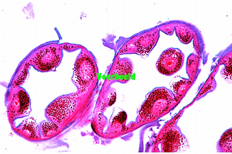 Malpighian tubules of insect, t.s.