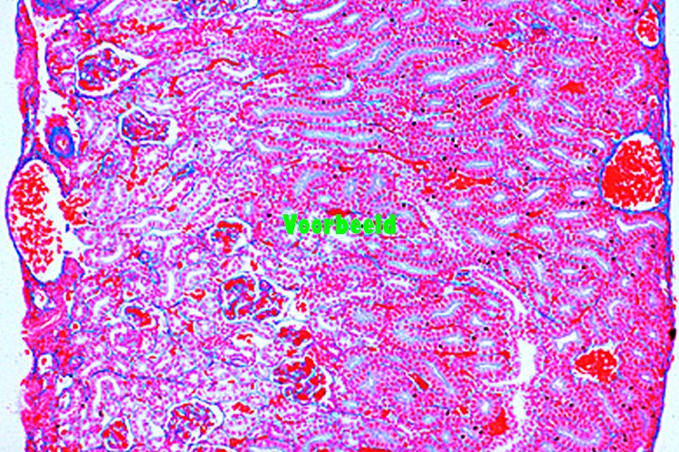 Primordial kidney (mesonephros) of frog,
