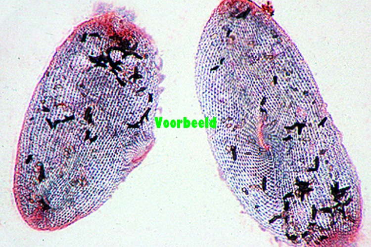 Paramaecium, silvered to show the neurof