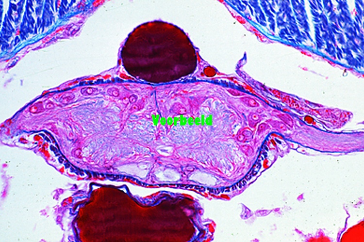 Lumbricus, earthworm, t.s. with ventral