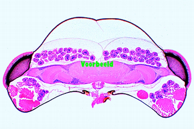 Insect brain, frontal l.s.