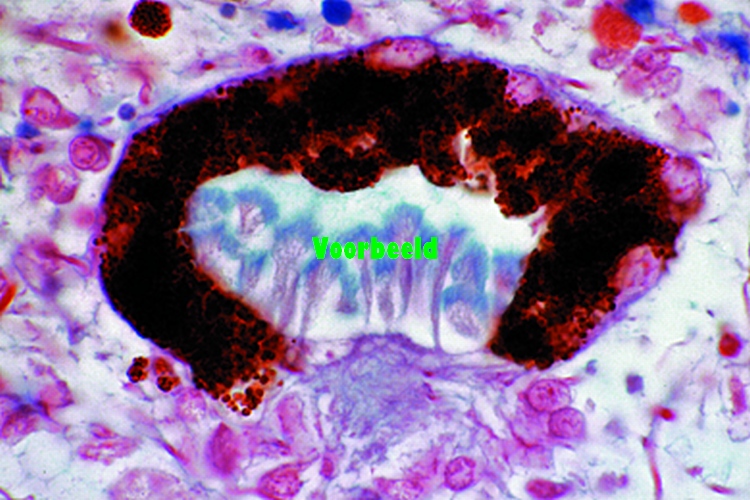 Planaria, sec. through ocelli