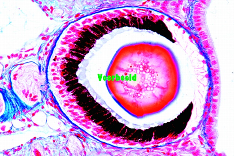 Helix, snail, eye l.s. lens, cornea, pig