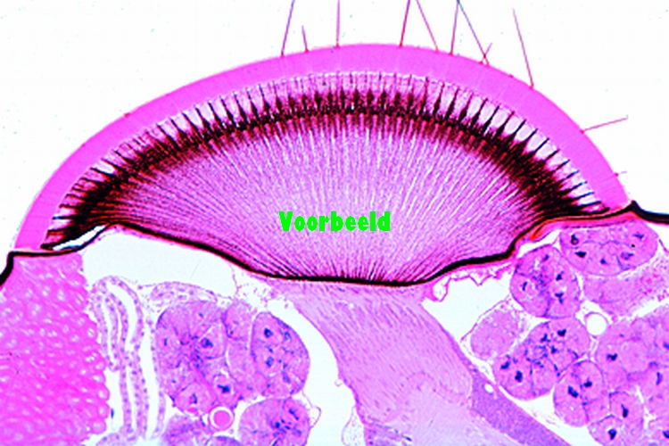 Compound eye of insect, l.s.