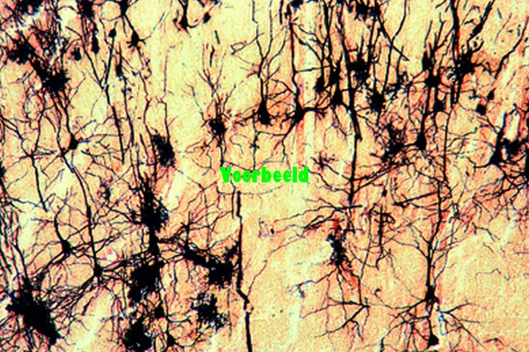 Cerebrum of cat, t.s. silvered to show t