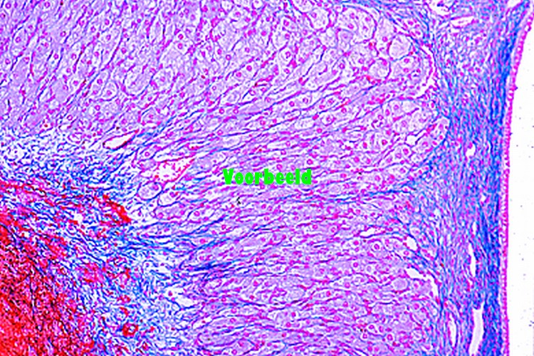 Ovary of cat, with follicles and corpus