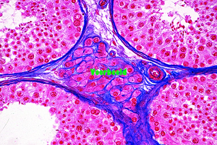Testis of mouse, t.s. showing Leydig's c