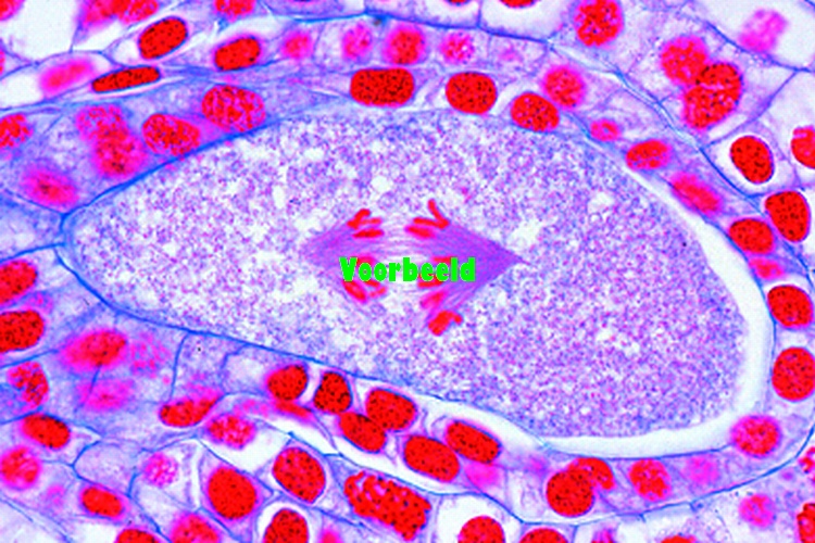 Lilium, ovary with embryosac t.s.