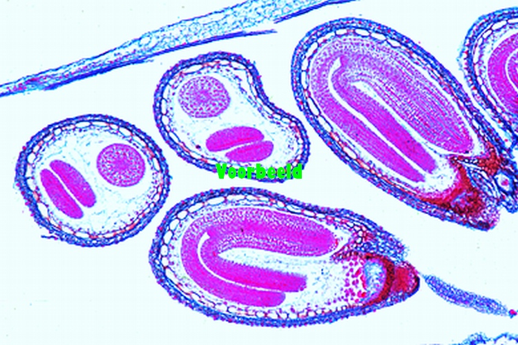 Capsella bursa pastoris, l.s. of embryos