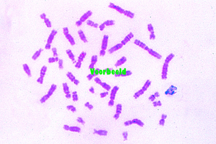 Human chromosomes, spread in the metapha