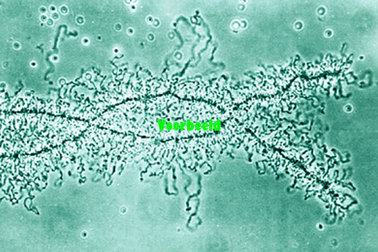 Lamp brush chromosomes