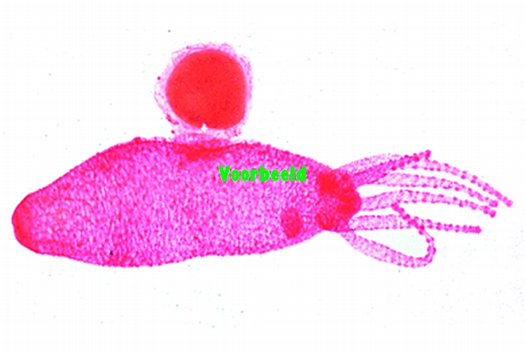Hydra with ovaries t.s., sexual reproduc