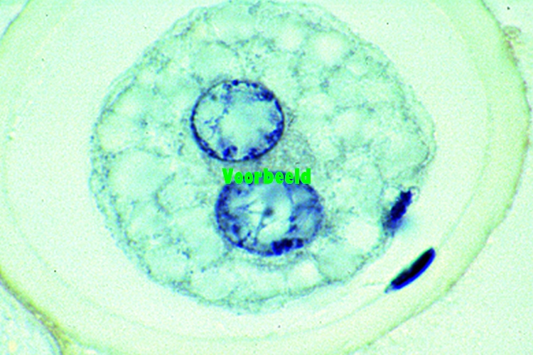 Ascaris embryology, sec. of uteri showin