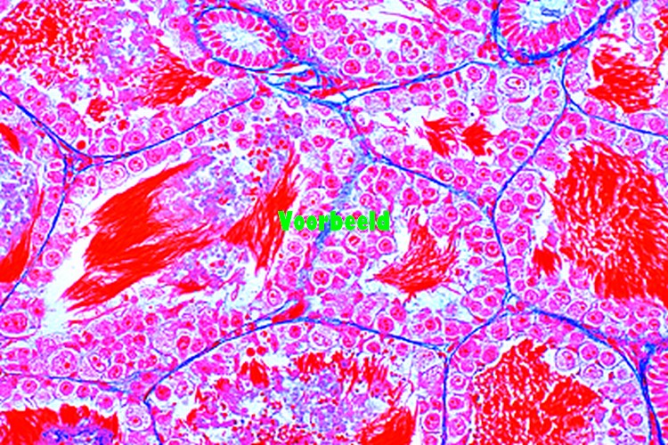 Frog (Rana), testis t.s. showing spermat