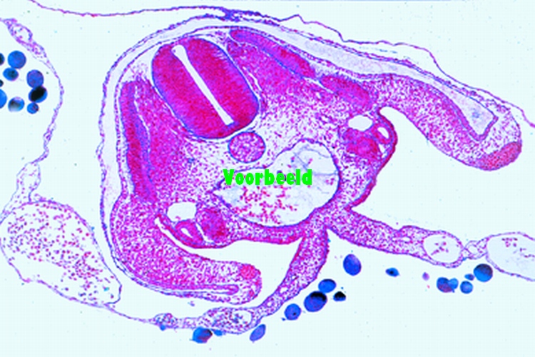 Chicken (Gallus) embryology: 72 hour t.s