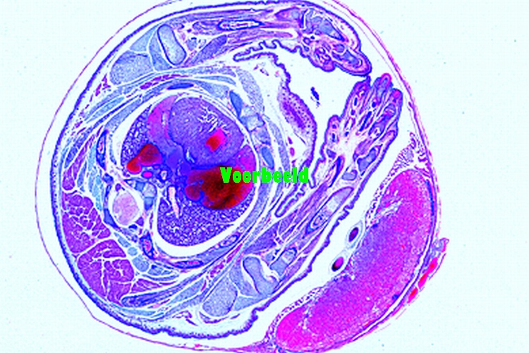Mouse, uterus containing embryo t.s.