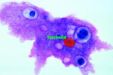 Amoeba proteus