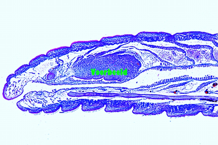 Preparaat regenworm